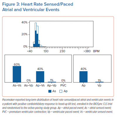 Heart Rate Sensed/Paced Atrial and Ventricular Events
