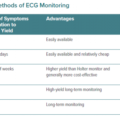 Comparison of Various Methods of ECG Monitoring