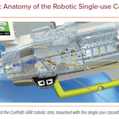 Anatomy of the Robotic Single-use Cassette