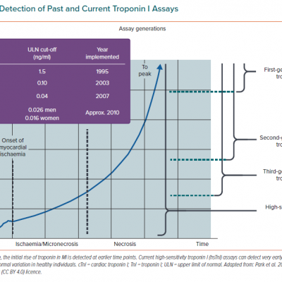 Limits of Detection of Past and Current Troponin I Assays