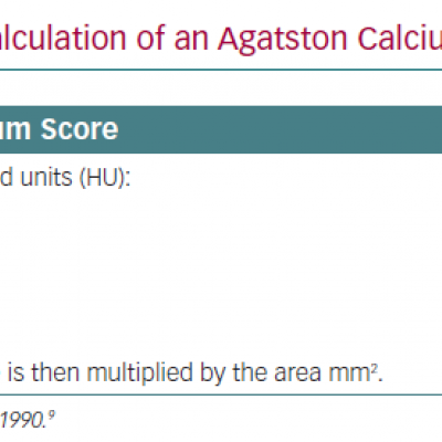 The Calculation of an Agatston Calcium Score