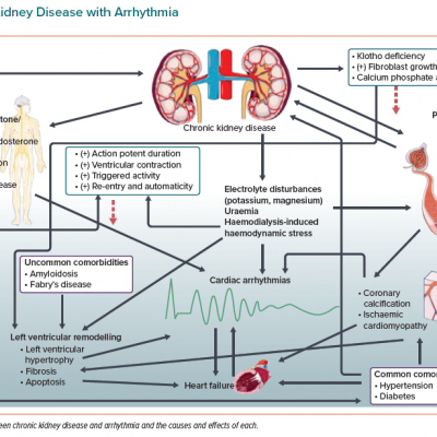 Chronic Kidney Disease with Arrhythmia