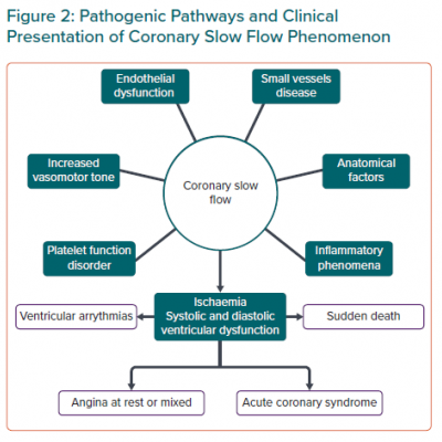 Pathogenic Pathways and Clinical Presentation of Coronary Slow Flow Phenomenon