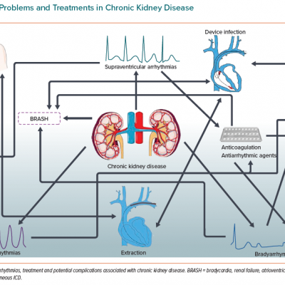 Cardiac Problems and Treatments in Chronic Kidney Disease