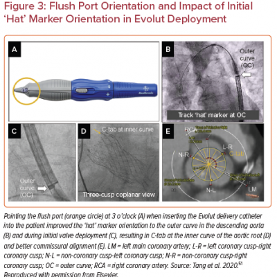 Flush Port Orientation and Impact of Initial ‘Hat’ Marker Orientation in Evolut Deployment