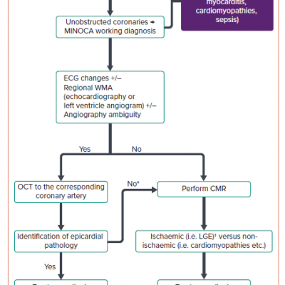 Clinical Algorithm for the Use of Optical Coherence Tomography in MINOCA
