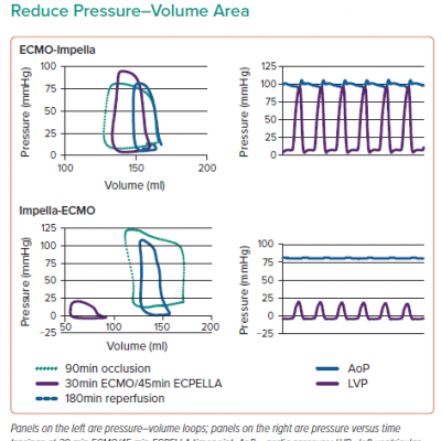 ECPELLA Can Dramatically Reduce Pressure–Volume Area