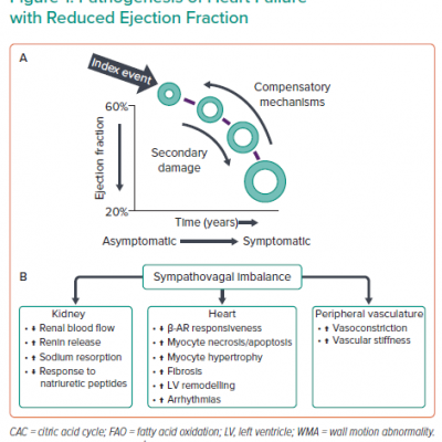 Pathogenesis of Heart Failure with Reduced Ejection Fraction