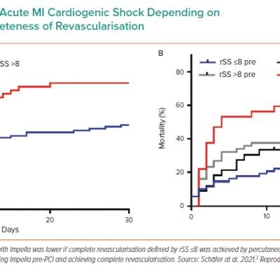 30-day Mortality in Acute MI Cardiogenic Shock Depending on Timing of Impella and Completeness of Revascularisation