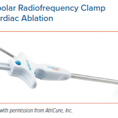 Bipolar Radiofrequency Clamp Used for Cardiac Ablation