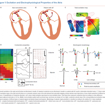 Excitation and Electrophysiological Properties of the Atria