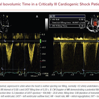Calculation of Total Isovolumic Time in a Critically Ill Cardiogenic Shock Patient