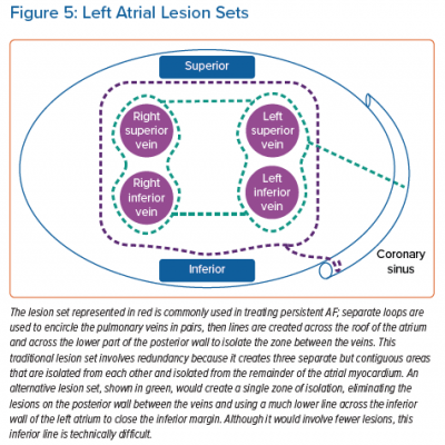 Left Atrial Lesion Sets