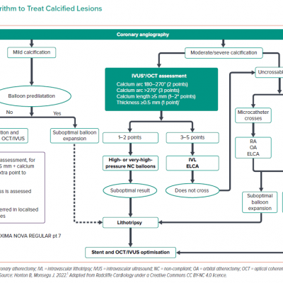 Algorithm to Treat Calcified Lesions