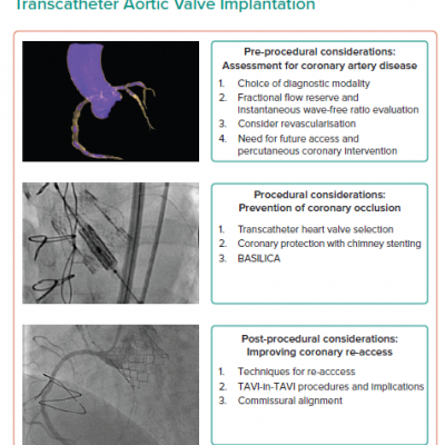 Considerations for Assessment and Management of Coronary Artery Disease in Transcatheter Aortic Valve Implantation