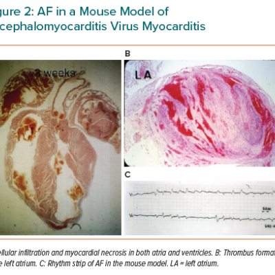 AF in a Mouse Model of Encephalomyocarditis Virus Myocarditis