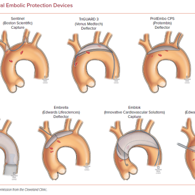 Cerebral Embolic Protection Devices
