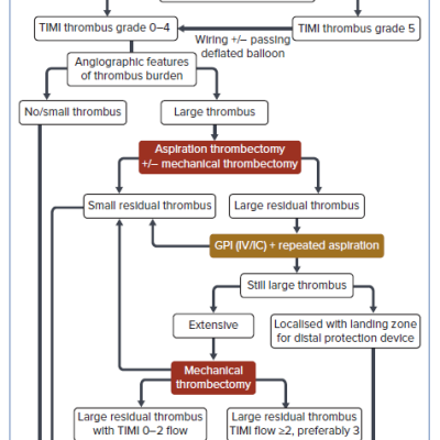 Proposed Algorithm for Thrombus Management During Primary Percutaneous Coronary Intervention