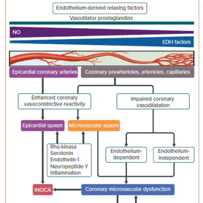 Vessel Size-dependent Contribution of Endothelium-derived Relaxing Factors and Mechanisms of Coronary Microvascular Dysfunction
