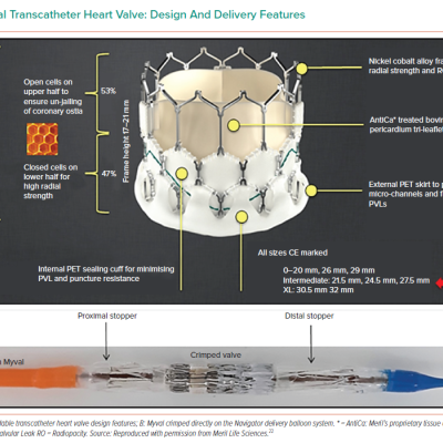 Myval Transcatheter Heart Valve Design And Delivery Features
