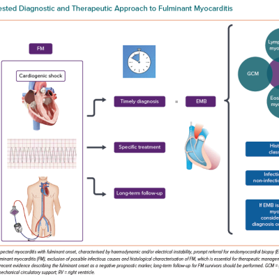 Suggested Diagnostic and Therapeutic Approach to Fulminant Myocarditis