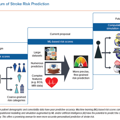The Conundrum of Stroke Risk Prediction