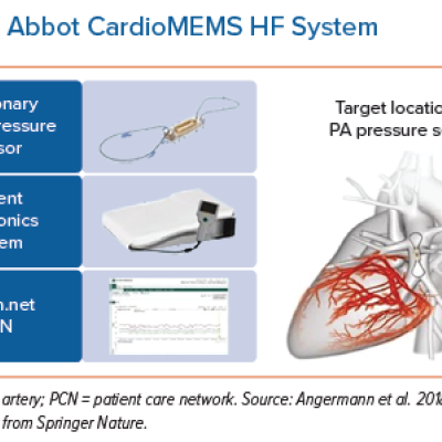 Abbot CardioMEMS HF System