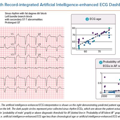 Electronic Health Record-integrated Artificial Intelligence-enhanced ECG Dashboard at the Mayo Clinic