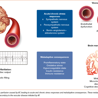 Acute and Chronic Brain Vascular Responses to Atrial Fibrillation