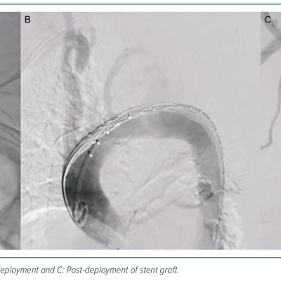 Figure 2 Cine Images of the Aorta