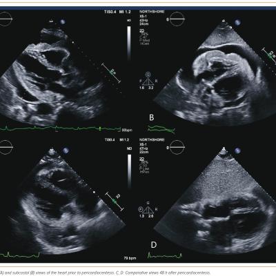 Figure 2 Transthoracic Echocardiogram Images