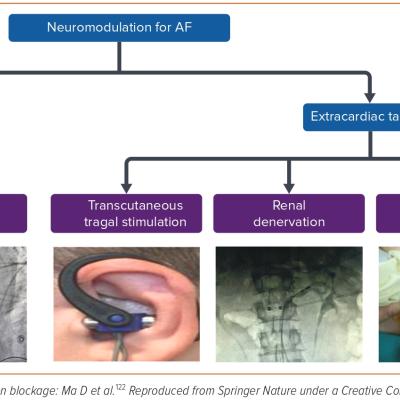 Figure 3 Sites of Neuromodulation in the Management of Atrial Fibrillation