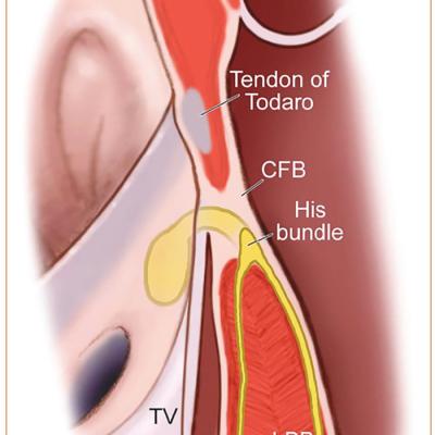 The Penetrating His Bundle in the Membranous Septum Giving Rise to the Left and Right Bundle Branches in the Interventricular Crest