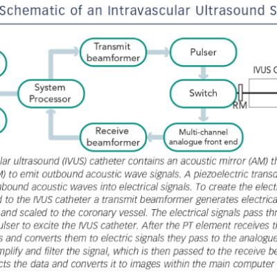 Schematic of an Intravascular Ultrasound System