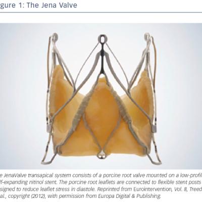 The Jena Valve