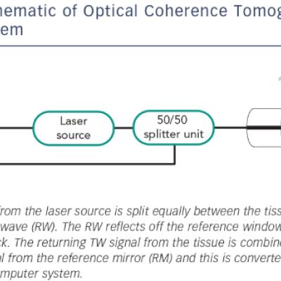 Schematic of Optical Coherence Tomography Imaging System