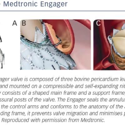 The Medtronic Engager