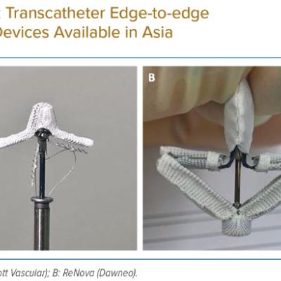 Transcatheter Edge-to-edge Repair Devices Available in Asia