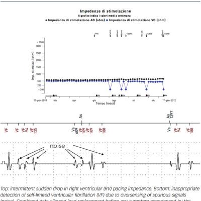  Early Detection of High Voltage Lead Failure by Continuous Remote Monitoring