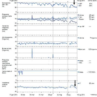 Multiparametric Heart Failure Monitoring in Cardiac Resynchronisation Therapy Patient