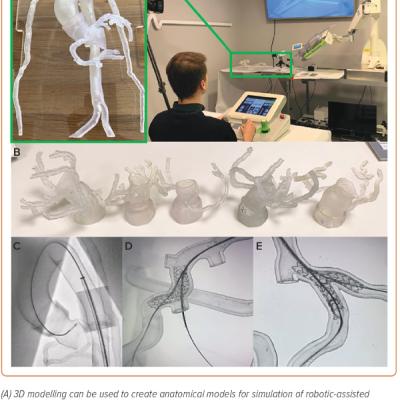 Figure 5 3D Modelling-based Simulation Training for Robotic-assisted Percutaneous Coronary Intervention