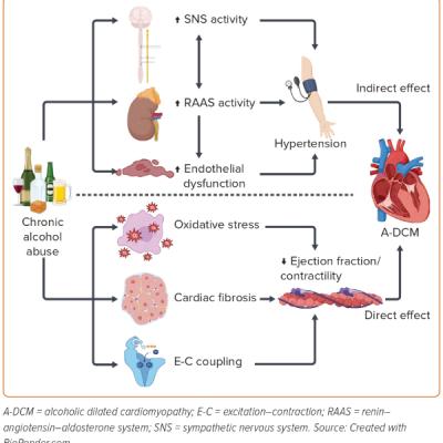 Figure 1 Direct and Indirect Mechanism of Non-ischaemic Dilated Alcoholic Cardiomyopathy