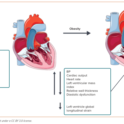 Figure 1 Maternal Cardiac Adaptation in Normal Pregnancy and in Women with Obesity