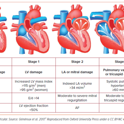 Figure 1 Cardiac Stratification of Aortic Stenosis Based on the Extent of Cardiac Damage