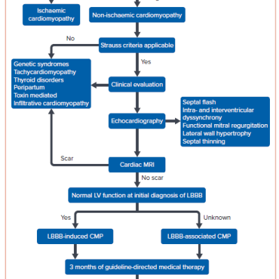 Figure 6 Approach to a Patient with Left Bundle Branch Block and Left Ventricular Dysfunction