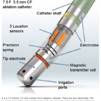 Figure 1 Diagram of the Novel ThermoCool® SmartTouch® Catheter