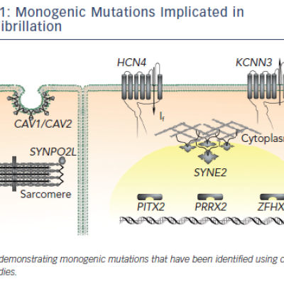 Figure 1 Monogenic Mutations Implicated in Atrial Fibrillation