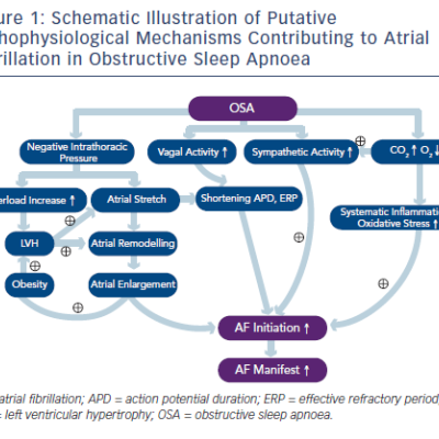 Schematic Illustration of Putative Pathophysiological Mechanisms Contributing to Atrial Fibrillation in Obstructive Sleep Apnoea