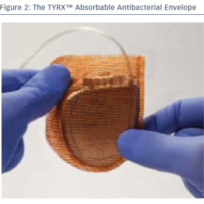 The TYRX™ Absorbable Antibacterial Envelope