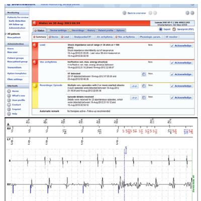 Figure 2 Top Print Screen of the Home Monitoring Webpage Indicating Red Alerts for a Patient who Received Multiple Shocks Due to Lead Fracture While on Holiday in the South of Italy Bottom Electrogram Recording Showing Artefacts on the Rate–Sense Ventricular Channel Indicating Lead Fracture